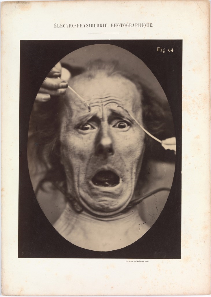 Archisearch - Adrien Tournachon (French, 1825–1903) Guillaume-Benjamin-Armand Duchenne de Boulogne (French, 1806–1875) Electro–Physiologie, Figure 64 1854–56, printed 1862 Albumen silver print from glass negative Purchase, The Buddy Taub Foundation Gift, Dennis A. Roach and Jill Roach, Directors, 2012 (2012.140)